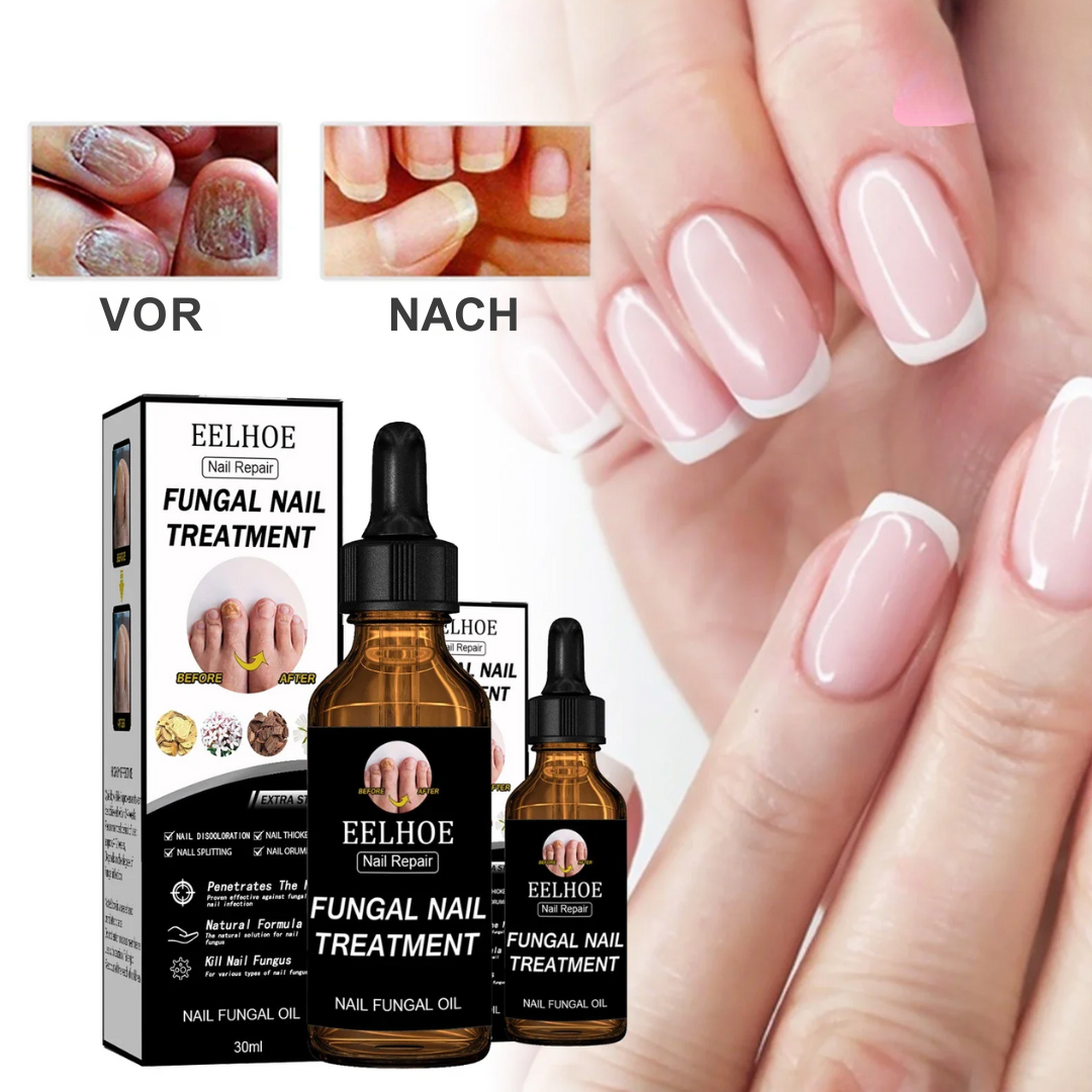 Nail Repair™ | Schädliche Nägel behandeln (1+1 GRATIS)