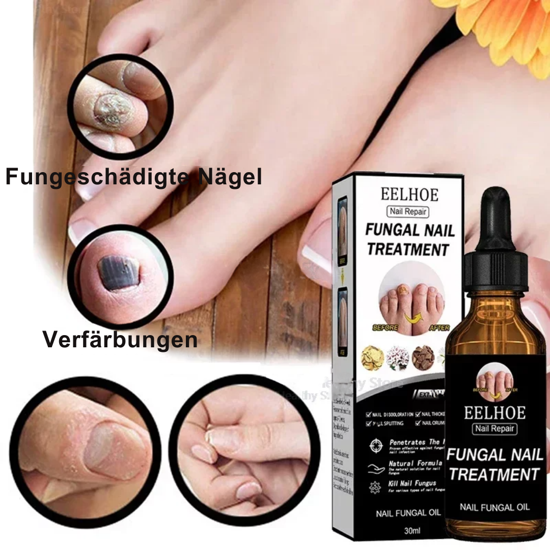 Nail Repair™ | Schädliche Nägel behandeln (1+1 GRATIS)